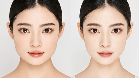 術前に精密な術後3D画像で仕上がりを確認できます